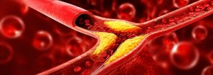 Xét Nghiệm Lipoprotein (a) Và Apolipoprotein B Là Gì?