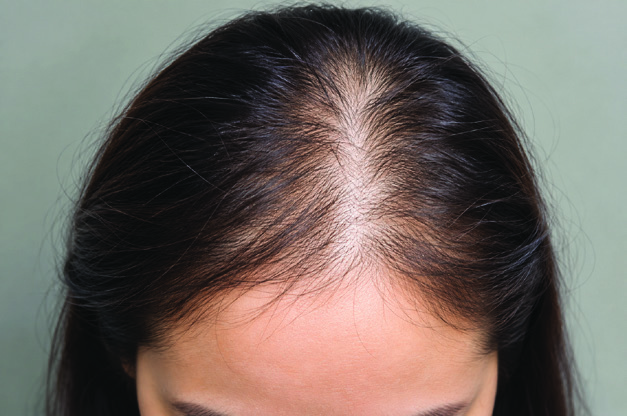 Scalp hair parting